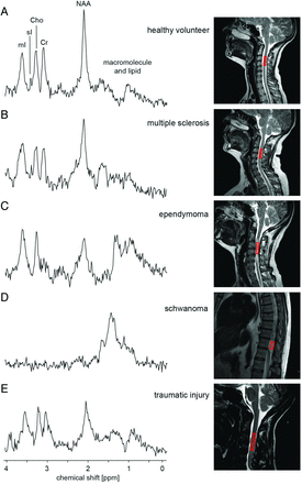 Fig 3.