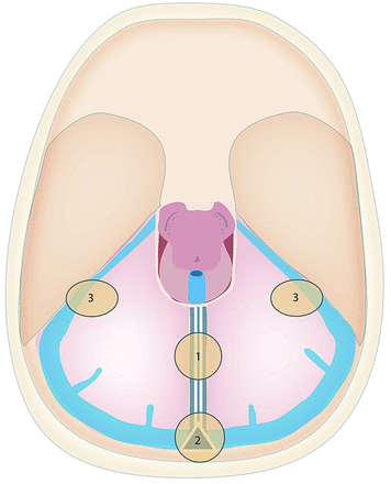 Fig 1.
