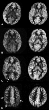 Fig 2.