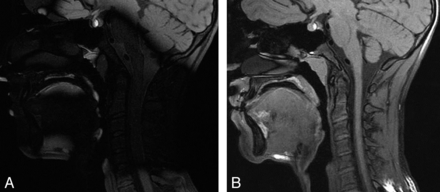 Fig 3.