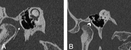 Fig 3.