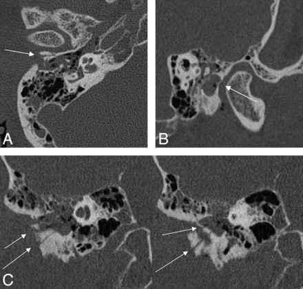 Fig 4.