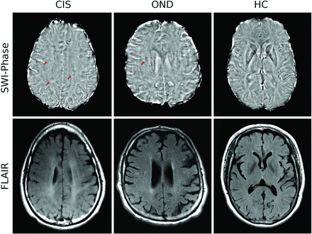 Fig 1.