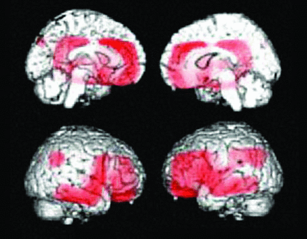 Fig 7.