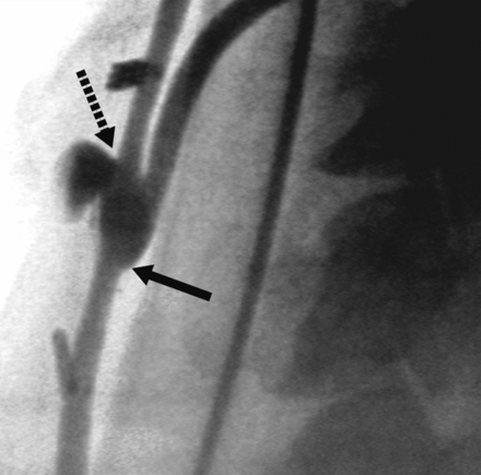 Fig 4.