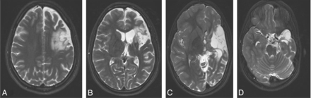 Fig 2.
