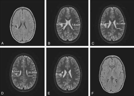Fig 3.