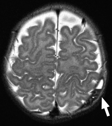 Fig 5.