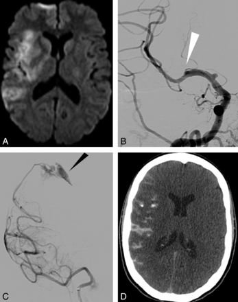 Fig 1.
