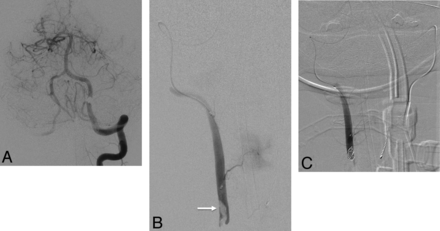 Fig 3.