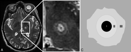 Fig 1.