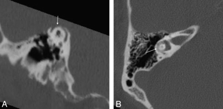 Fig 10.
