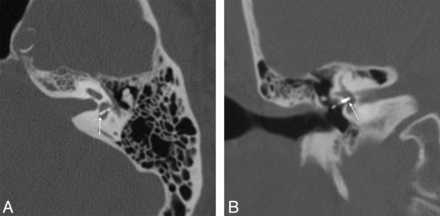 Fig 7.