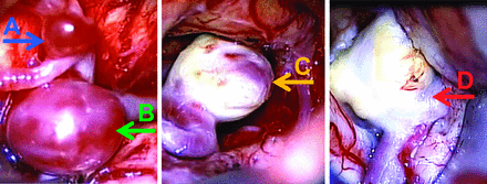 Fig 3.