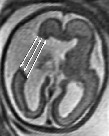 Fig 1.