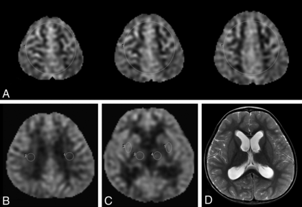 Fig 1.