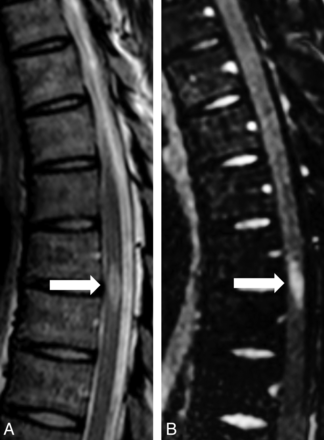 Fig 6.