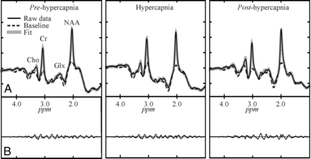 Fig 1.