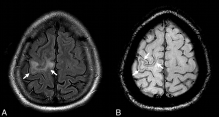 Fig 2.