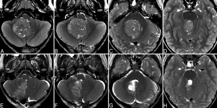 Fig 3.