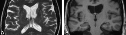 Fig 1.