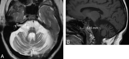 Fig 2.