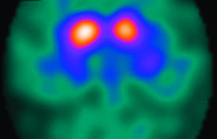 Fig 5.