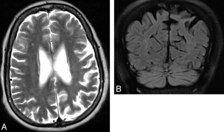 Fig 7.