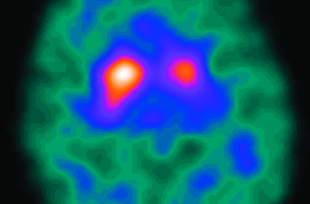 Fig 8.