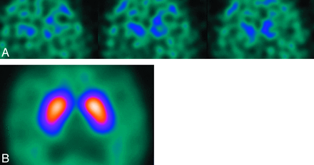 Fig 9.