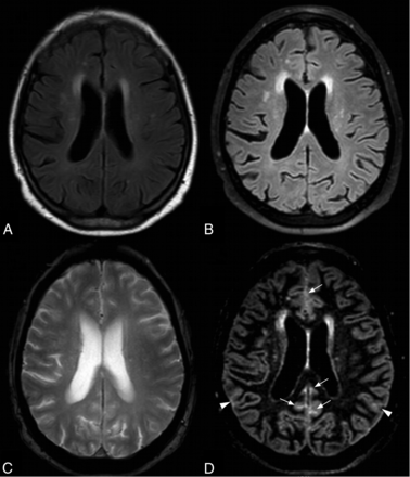 Fig 3.