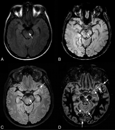 Fig 4.