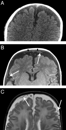 Fig 4.