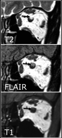 Fig 1.