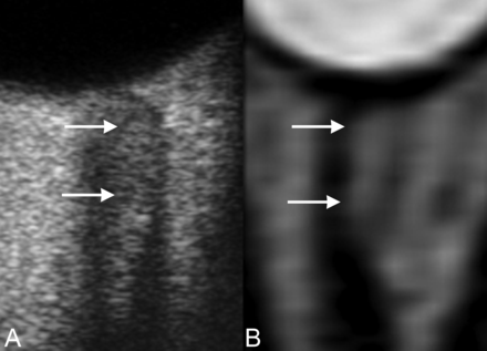Fig 2.