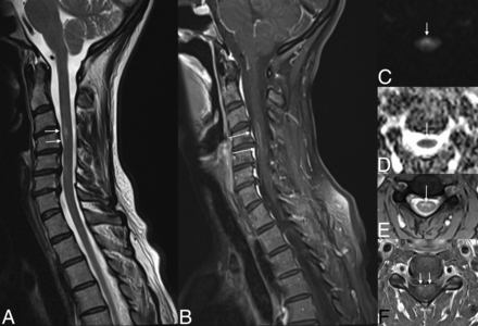 Fig 6.