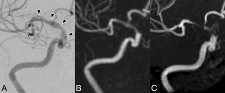 Fig 2.