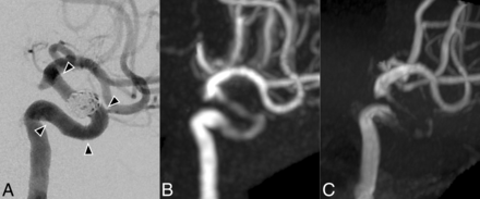 Fig 3.