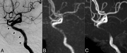 Fig 5.