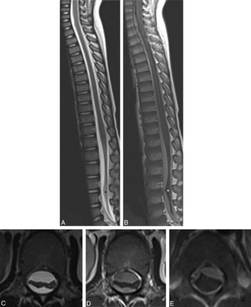 Fig 2.
