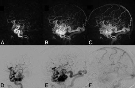 Fig 2.