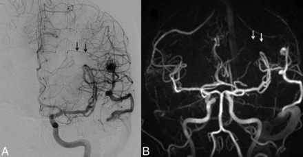 Fig 5.