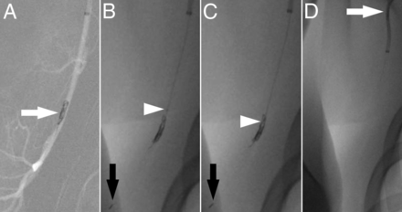 Fig 3.