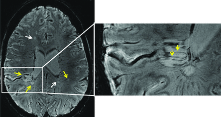 Fig 10.