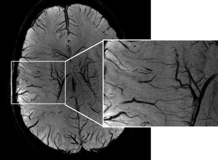 Fig 2.