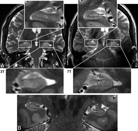 Fig 7.