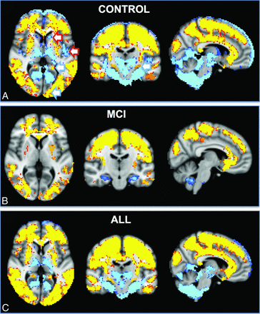 Fig 4.