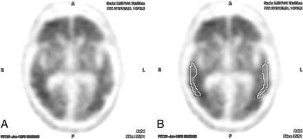 Fig 2.