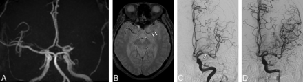 Fig 1.