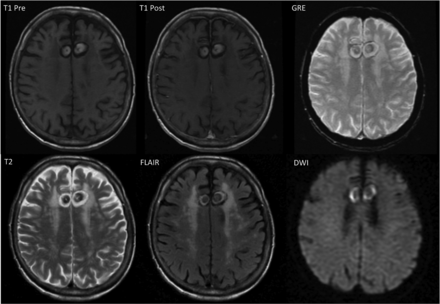 Fig 3.